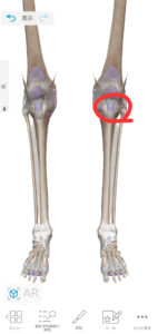 膝の痛みの部位